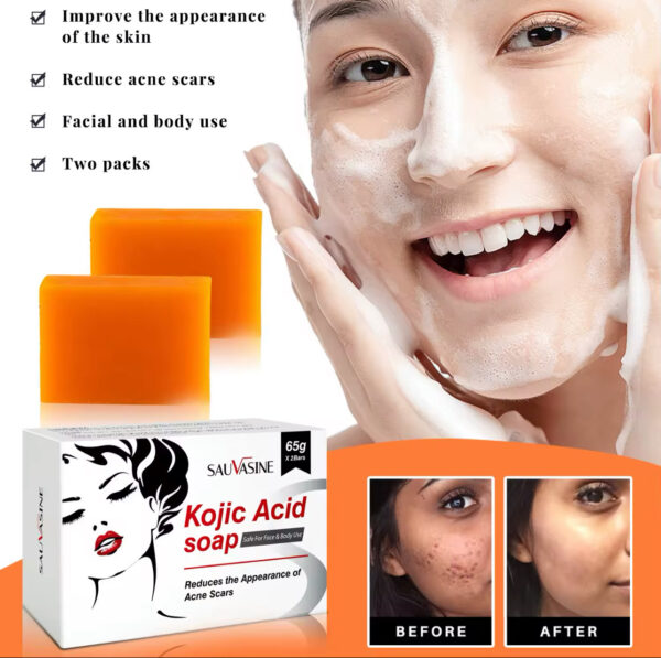 Kojic Acid Soap
